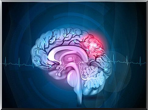 Brain with red areas for pain to represent the chemobrain