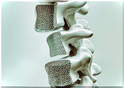 Osteoporosis